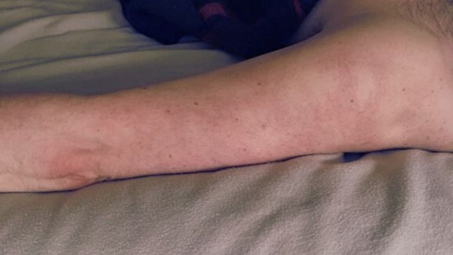 Thumbnail for: Top Exercises to Improve Circulation and Reduce Blood Pooling