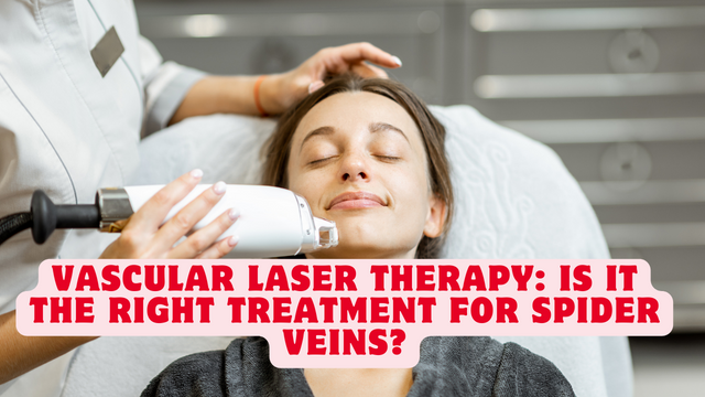 Thumbnail for: Vascular Laser Therapy: Is It the Right Treatment for Spider Veins?
