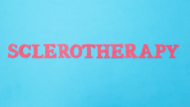 Thumbnail for: 15 Tips About Sclerotherapy Costs From Industry Experts