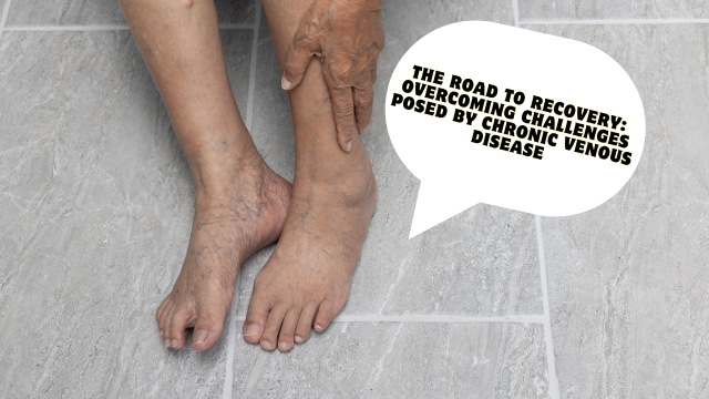 Thumbnail for: The Road to Recovery: Overcoming Challenges Posed by Chronic Venous Disease